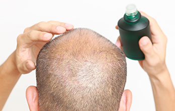 若はげ対策・改善方法